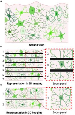 The Shape of μ—How Morphological Analyses Shape the Study of Microglia